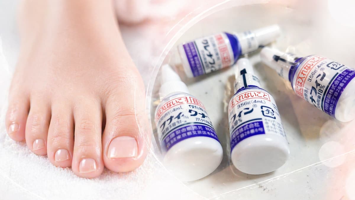 女性の足と爪水虫の塗り薬クレナフィン4つ