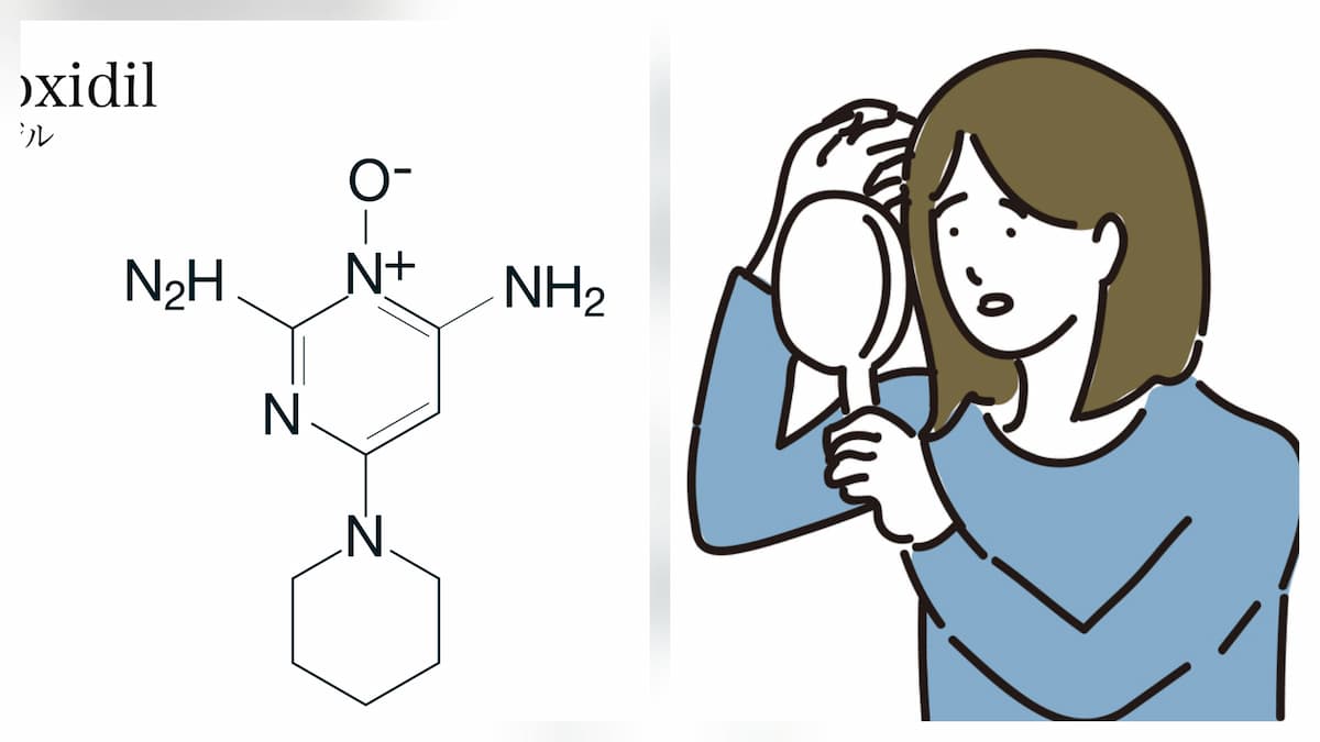 ミノキシジルと女性の薄毛